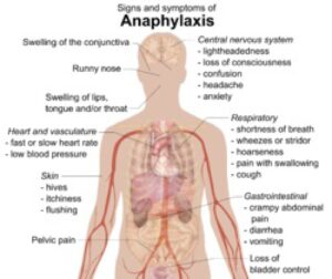 Read more about the article پاورپوینت کامل و جامع با عنوان بررسی بیماری آنافیلاکسی در 49 اسلاید