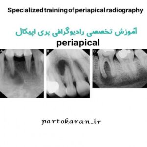 Read more about the article آموزش تخصصی رادیوگرافی پری اپیکال