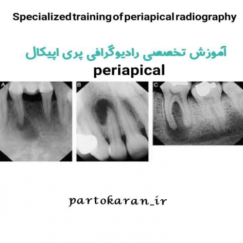 You are currently viewing آموزش تخصصی رادیوگرافی پری اپیکال