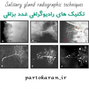 Read more about the article تکنیک های تخصصی رادیوگرافی غدد بزاقی