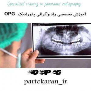 Read more about the article آموزش تخصصی رادیوگرافی پانورامیک (  OPG )
