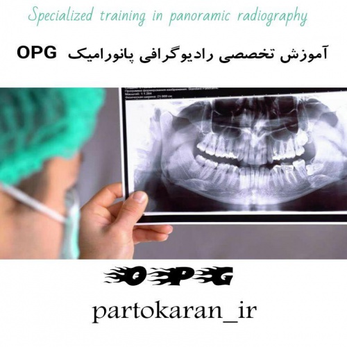 You are currently viewing آموزش تخصصی رادیوگرافی پانورامیک (  OPG )