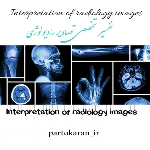 You are currently viewing آموزش تخصصی تفسیر تصاویر رادیولوژی