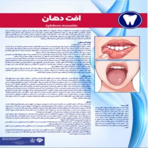 Read more about the article پوستر افت دهان – مجموعه پوسترهای دندانپزشکی