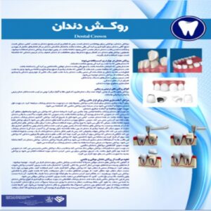 Read more about the article پوستر روکش دندان- مجموعه پوسترهای دندانپزشکی