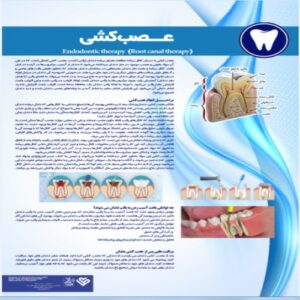 Read more about the article پوستر عصب کشی دندان- مجموعه پوسترهای دندانپزشکی