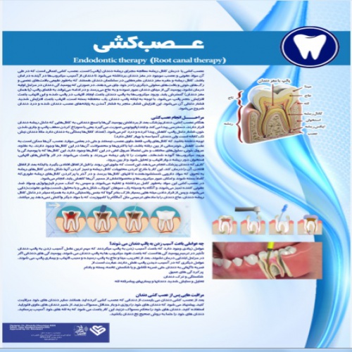 You are currently viewing پوستر عصب کشی دندان- مجموعه پوسترهای دندانپزشکی