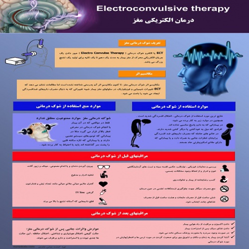 Read more about the article پوستر شوک درمانی یا درمان الکتریکی مغز ECT
