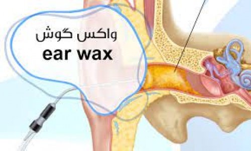 Read more about the article واکس گوش(Ear Wax)