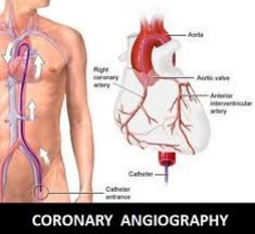 You are currently viewing پاورپوینت برگزاری کارگاه و تدریس angiography( آموزش کامل آنژیوگرافی)