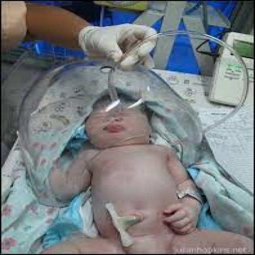 You are currently viewing پاورپوینت آماده کنفرانس و برگزاری کارگاه آموزشی دیسترس تنفسی در نوزادان (Respiratory Diseases of  the Newborn)