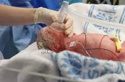 You are currently viewing پاورپوینت آماده ارائه کنفرانس احیاء نوزادان (Neonatal resuscitation)